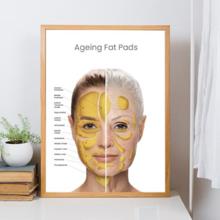 Aging Fat Pad Poster Laminated